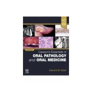 Cawson's Essentials of Oral Pathology and Oral Medicine