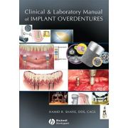 Clinical and Laboratory Manual of Implant Overdentures