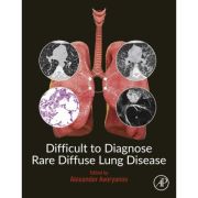 Difficult to Diagnose Rare Diffuse Lung Disease