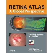 Retina Atlas: A Global Perspective