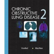 Chronic Obstructive Lung Disease: 2