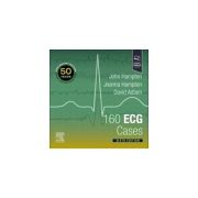 160 ECG Cases