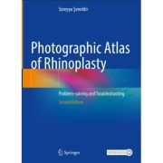 Photographic Atlas of Rhinoplasty
Problem-solving and Troubleshooting