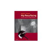 Hip Resurfacing, Principles, Indications, Technique and Results Book and DVD