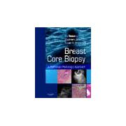 Breast Core Biopsy, A Pathologic-Radiologic Approach