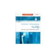 Arthritis and Arthroplasty: The Hip Expert Consult - Online, Print and DVD