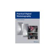 Practical Digital Mammography