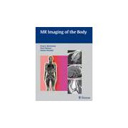 MR Imaging of the Body