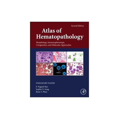 atlas of cytogenetics hematology oncology
