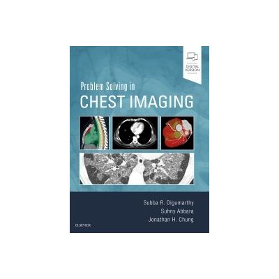 Problem Solving in Chest Imaging
