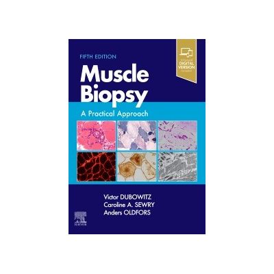 Muscle Biopsy,
A Practical Approach