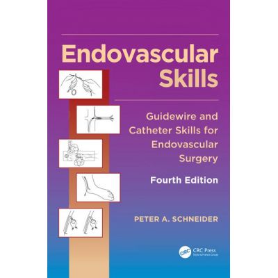 Endovascular Skills
Guidewire and Catheter Skills for Endovascular Surgery