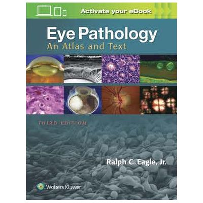 Eye Pathology
An Atlas and Text