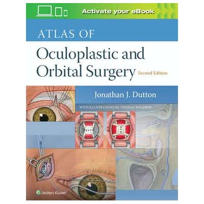 Atlas of Oculoplastic and Orbital Surgery