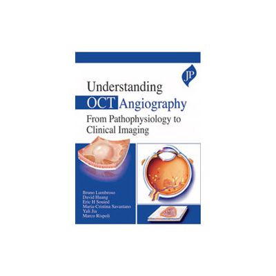 Understanding OCT Angiography: From Pathophysiology to Clinical Imaging