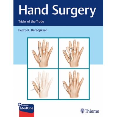 Hand Surgery
Tricks of the Trade