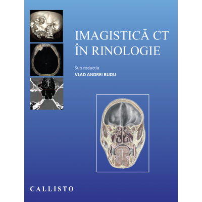 Imagistica CT in rinologie