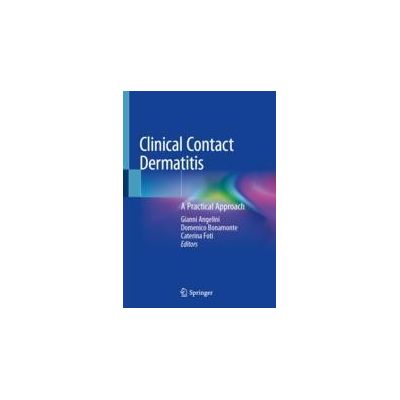 Clinical Contact Dermatitis
A Practical Approach