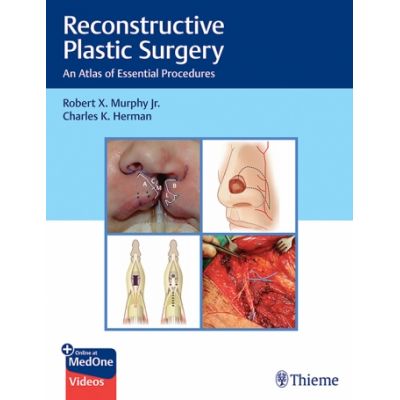 Reconstructive Plastic Surgery
An Atlas of Essential Procedures