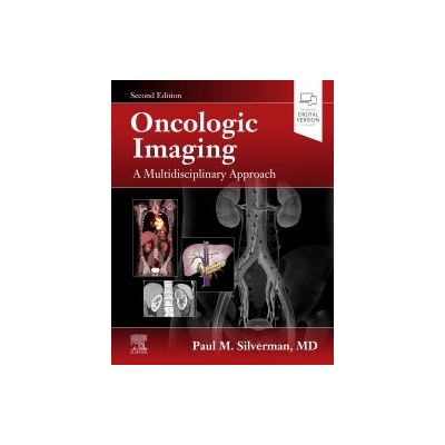 Oncologic Imaging: A Multidisciplinary Approach