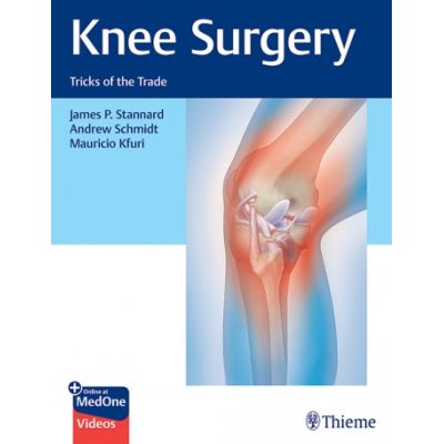Knee Surgery
Tricks of the Trade