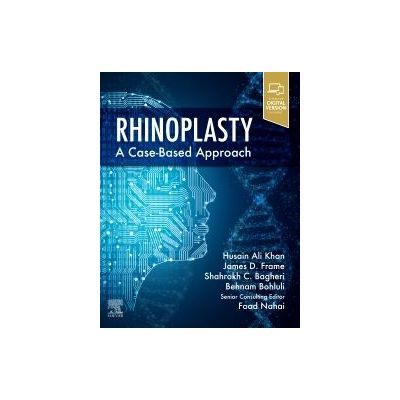 Rhinoplasty, 
a Case-based approach