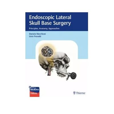 Endoscopic Lateral Skull Base Surgery
Principles, Anatomy, Approaches
