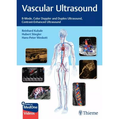 Vascular Ultrasound
B-Mode, Color Doppler and Duplex Ultrasound, Contrast-Enhanced Ultrasound
